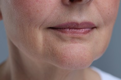 Photo of Senior woman with aging skin on grey background, closeup. Rejuvenation treatment