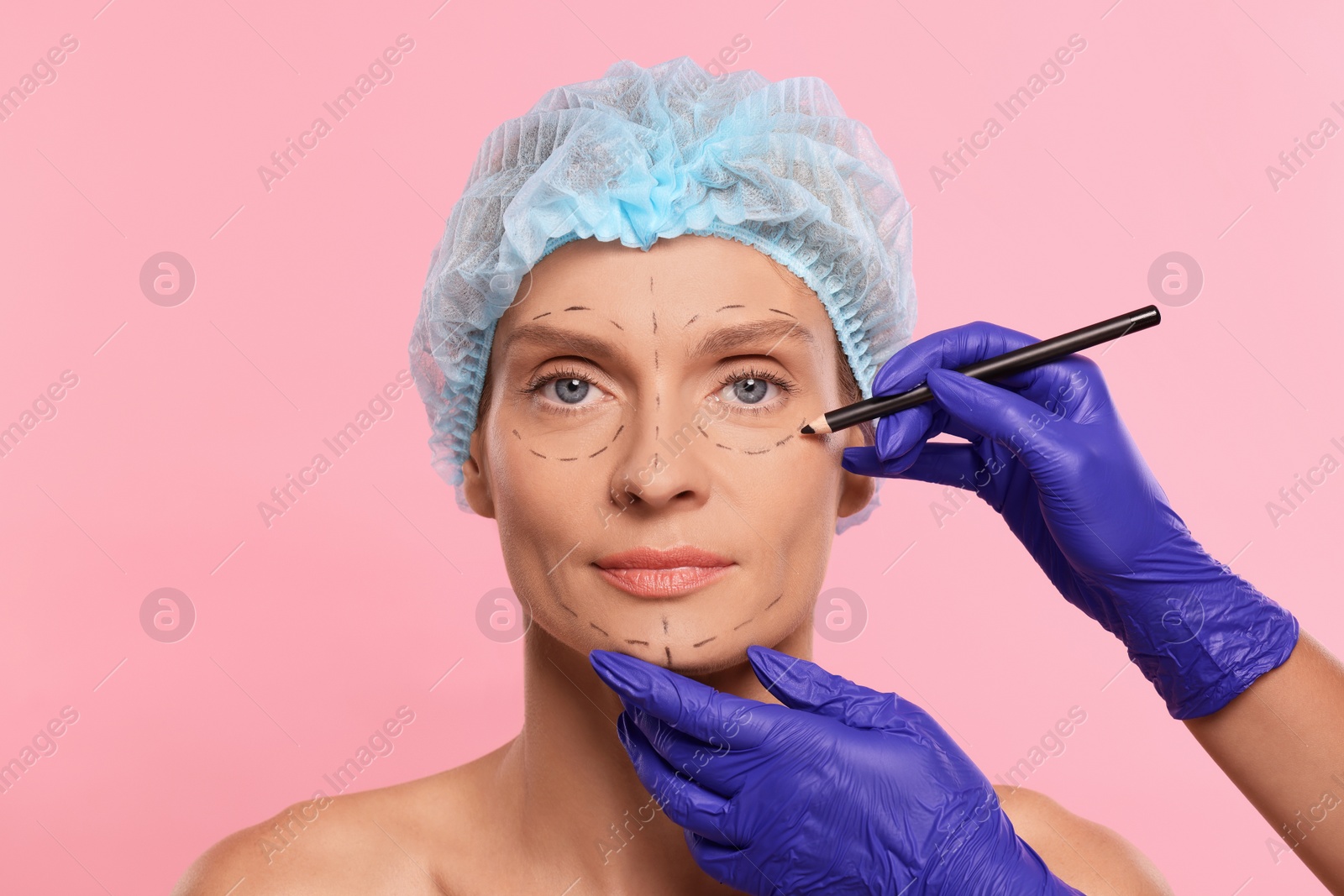 Photo of Doctor with pencil preparing patient for cosmetic surgery operation on pink background