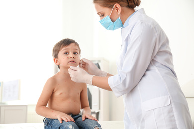 Doctor examining little boy with chickenpox in clinic. Varicella zoster virus