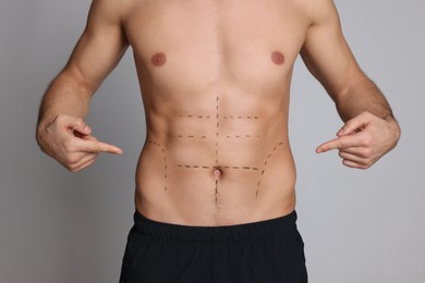 Photo of Fit man with marks on body against grey background, closeup. Weight loss surgery