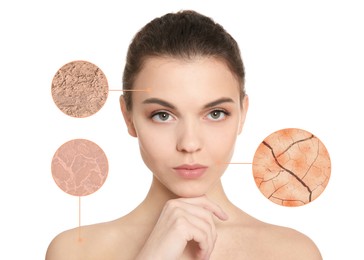 Young woman with dry skin problem on white background
