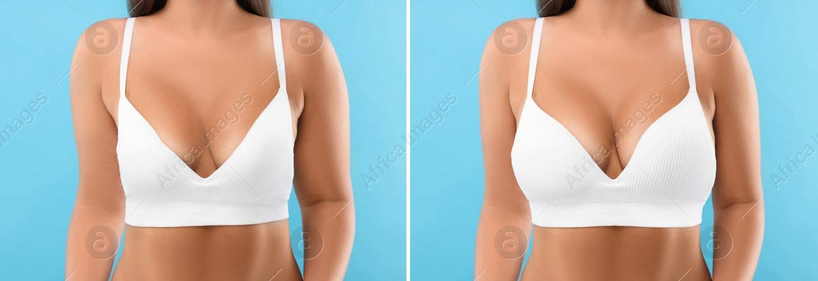 Image of Woman before and after breast augmentation on light blue background, closeup. Collage with photos showing difference between breast sizes