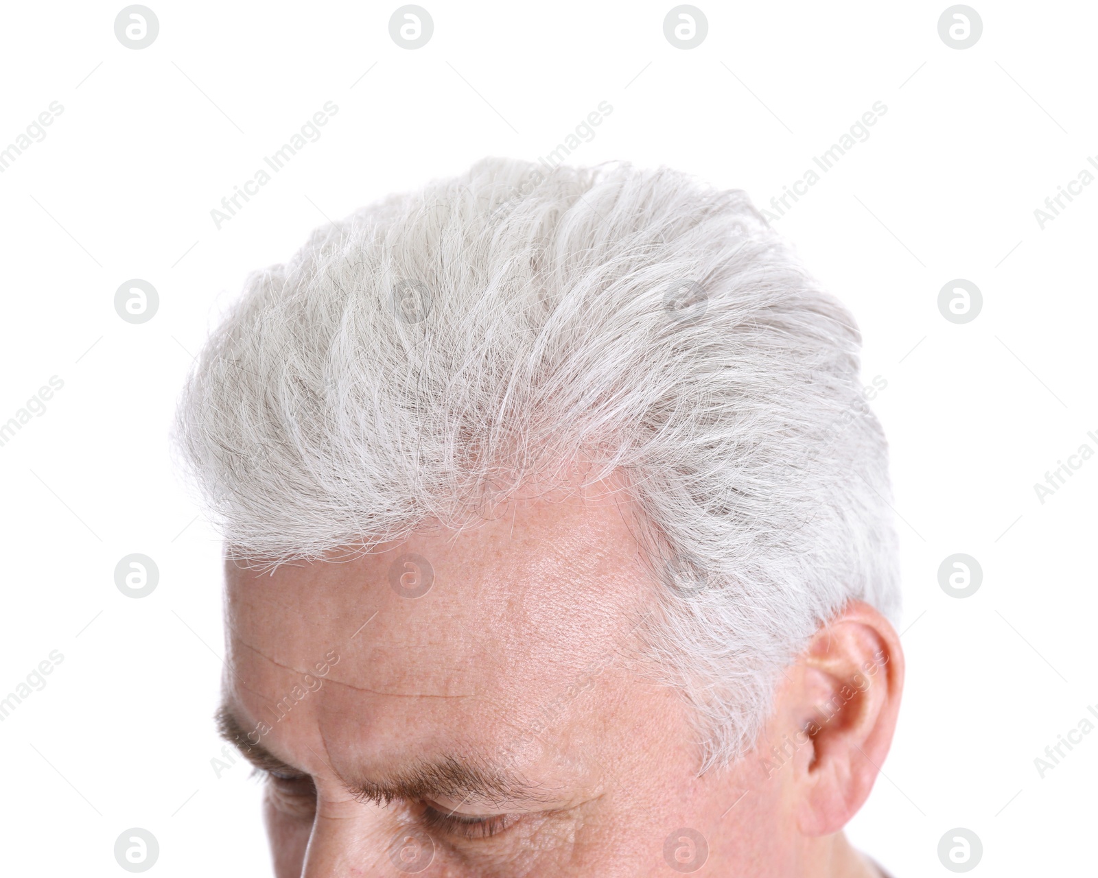 Photo of Senior man with hair loss problem isolated on white, closeup