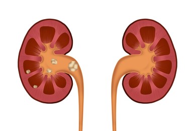 Illustration of  human kidney stones on white background
