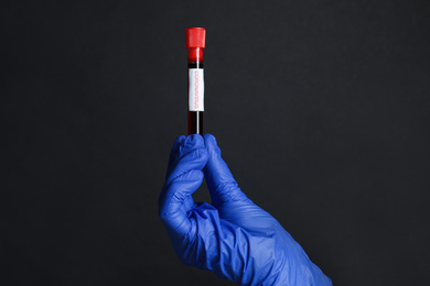 Photo of Scientist holding test tube with blood sample and label CORONA VIRUS on black background, closeup