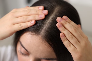 Photo of Woman examining her hair and scalp on blurred background, closeup