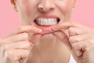 Woman showing her clean teeth on pink background, closeup