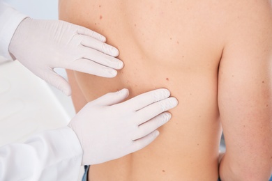 Dermatologist examining patient's birthmark in clinic, closeup