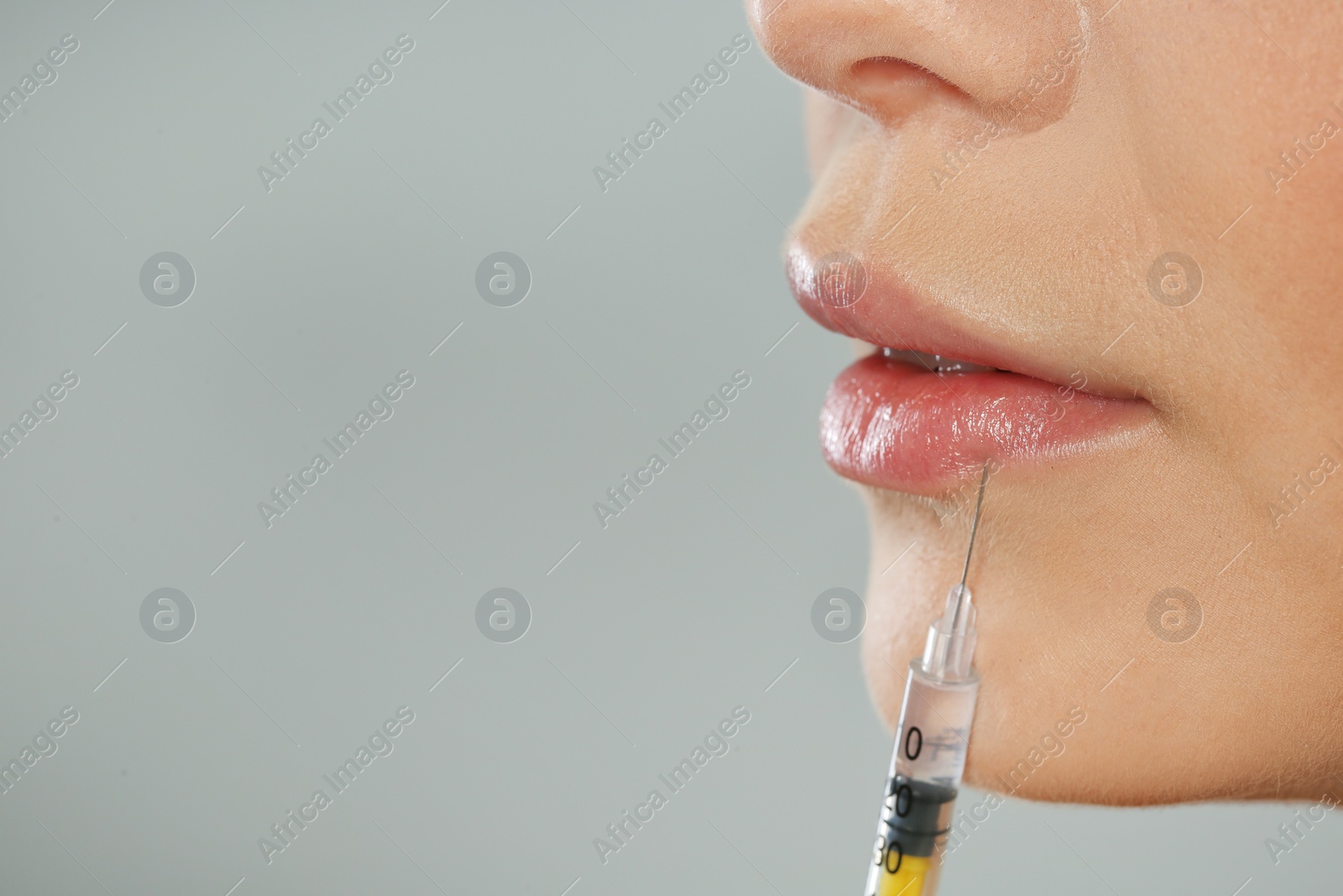 Photo of Young woman getting lips injection on grey background, space for text. Cosmetic surgery