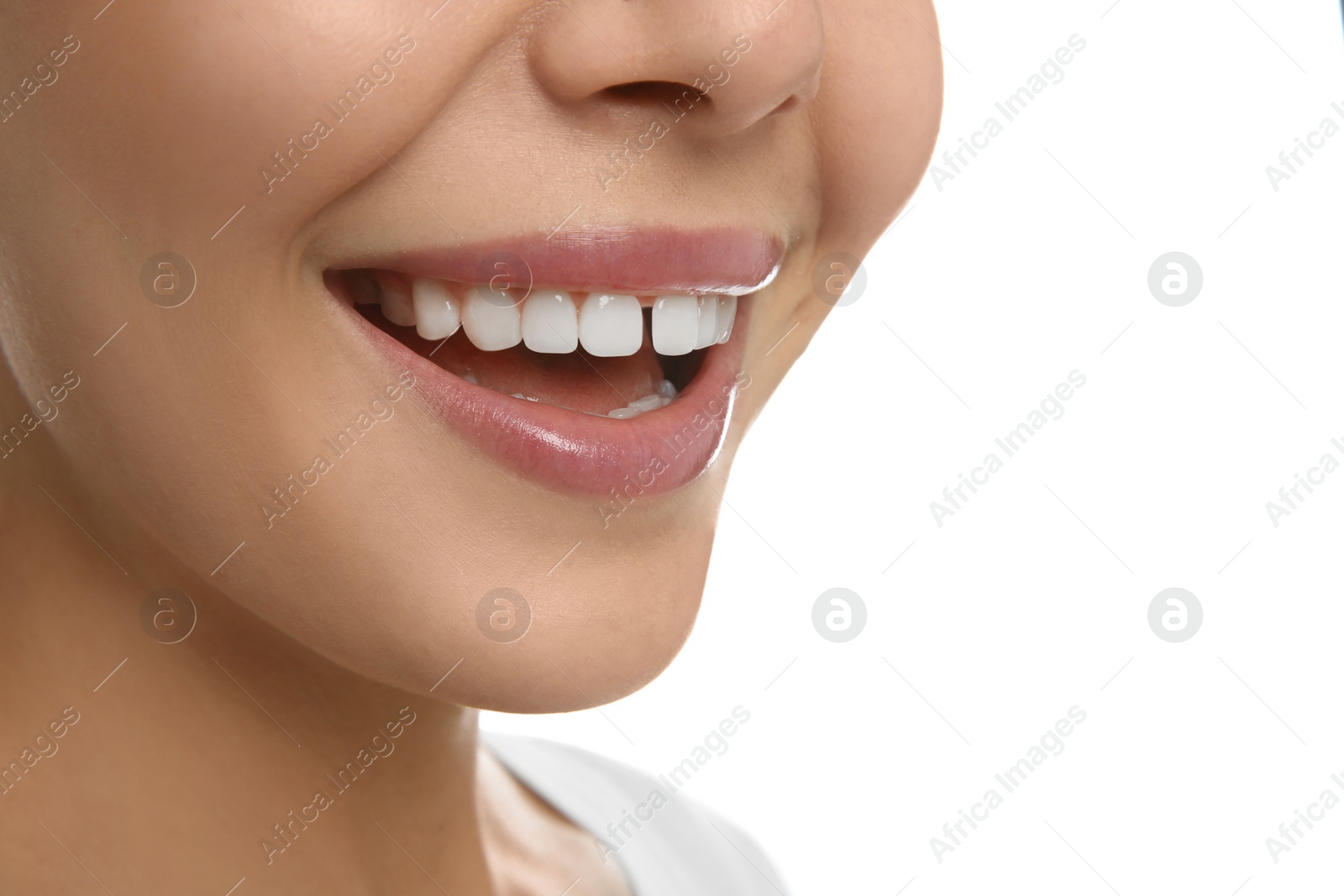 Image of Woman with diastema between upper front teeth on white background, closeup