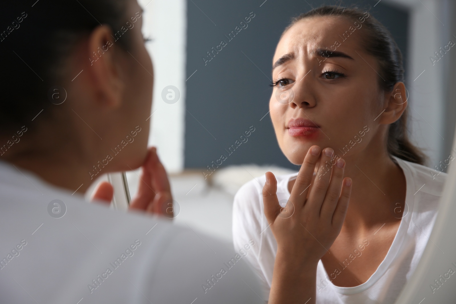Photo of Young woman with herpes on lip looking in mirror at home