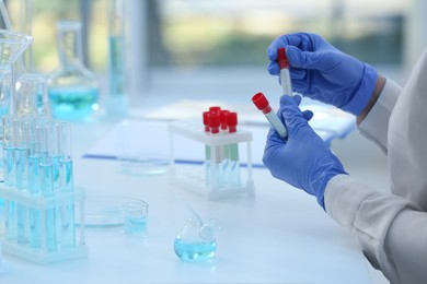 Photo of Scientist working with samples in laboratory, closeup. Medical research