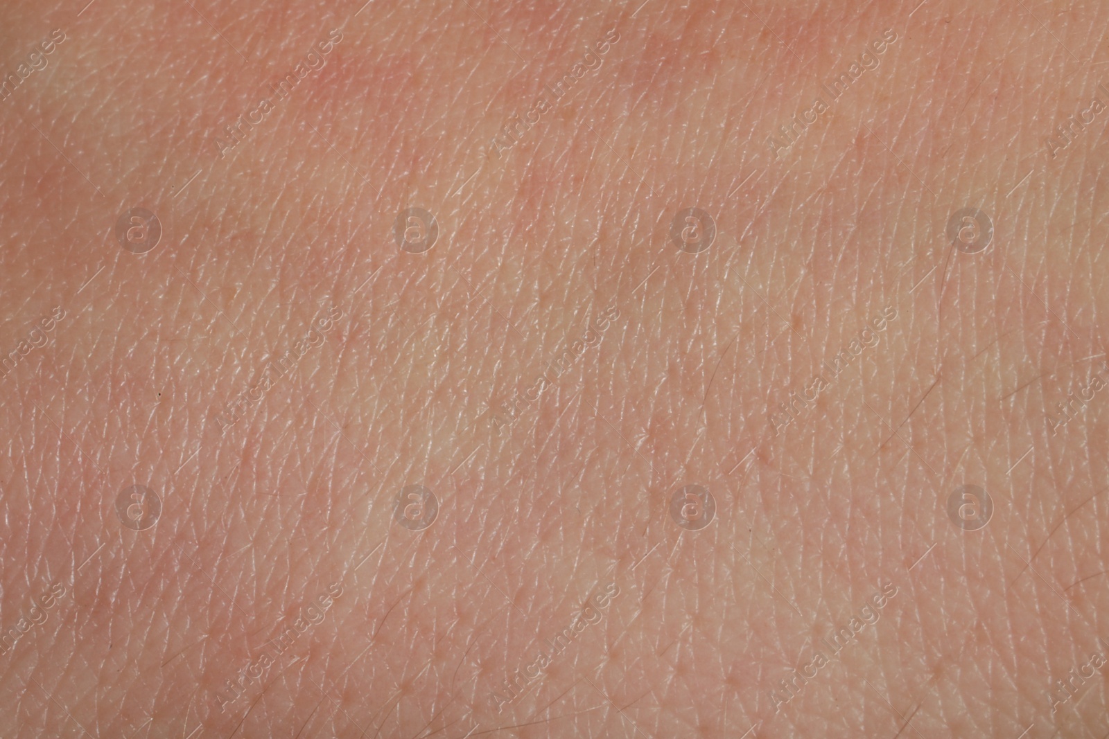 Photo of Closeup view of dry human skin as background