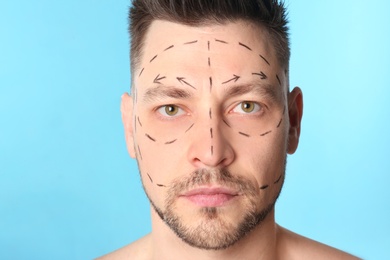 Man with marks on face for cosmetic surgery operation against blue background, closeup