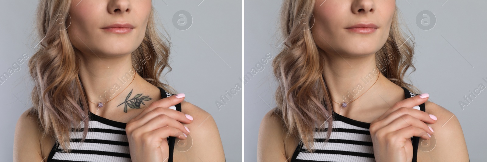 Image of Woman before and after laser tattoo removal procedure on light grey background, closeup. Collage with photos, banner design