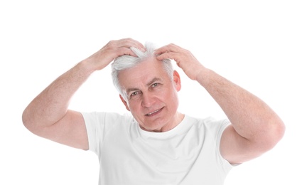 Senior man with hair loss problem isolated on white