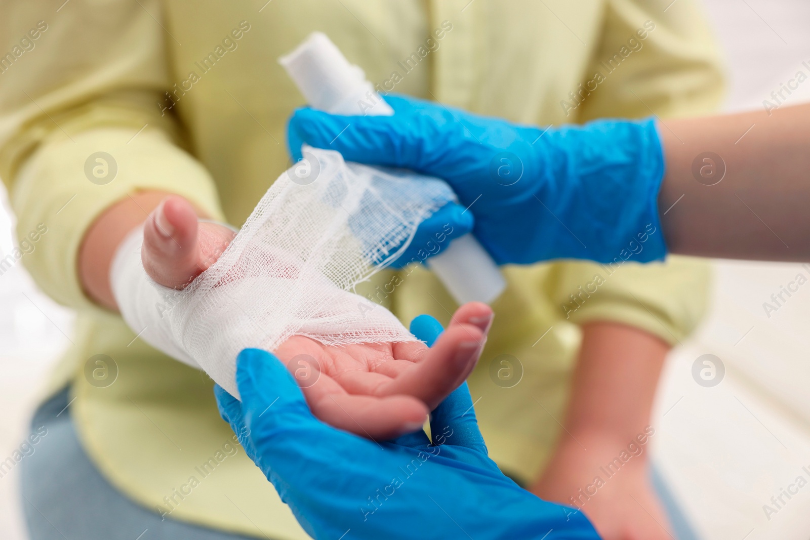 Photo of Doctor bandaging patient's burned hand indoors, closeup