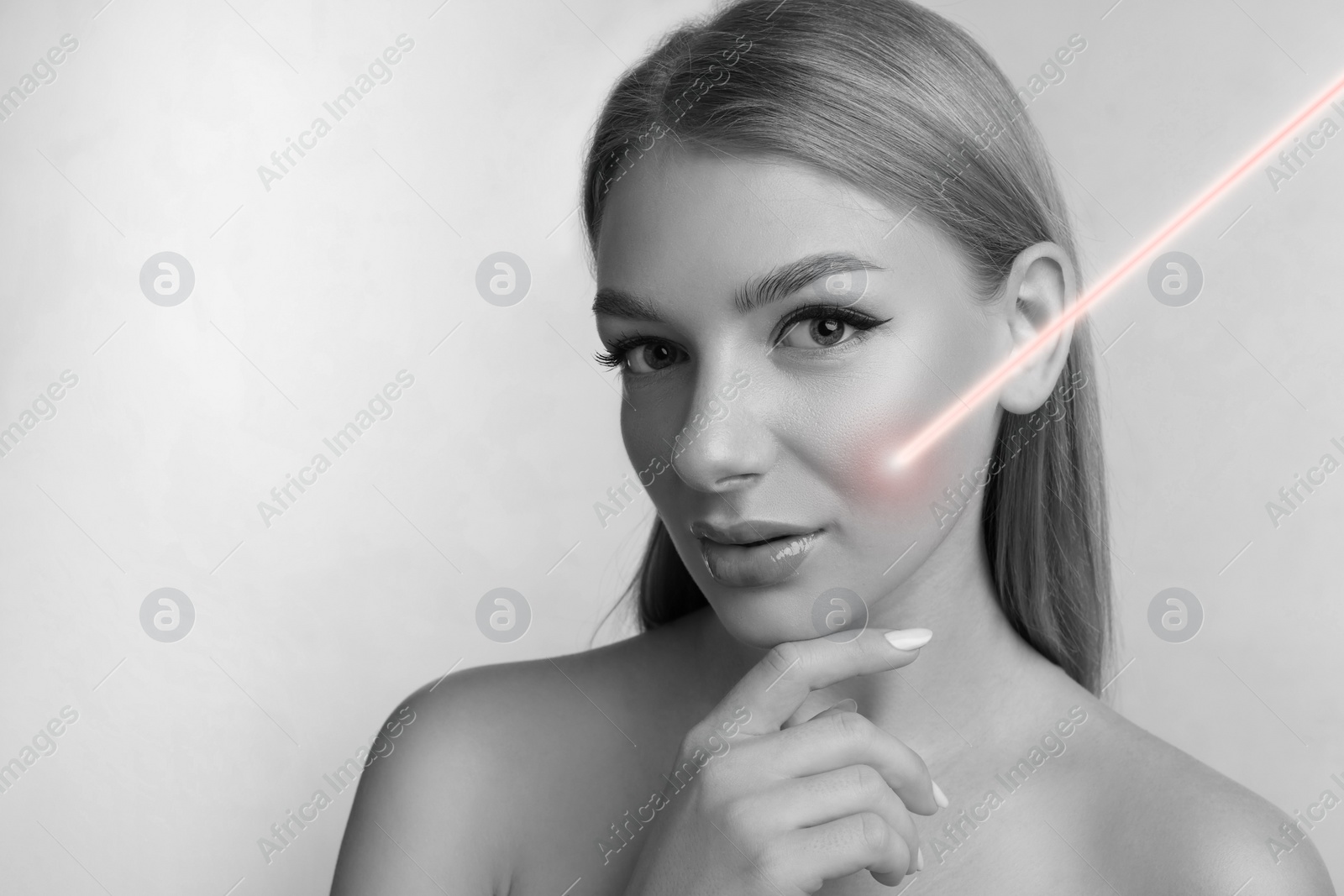 Image of Laser mole removal. Woman with ray pointed at her skin during procedure on grey background, space for text. Black and white effect