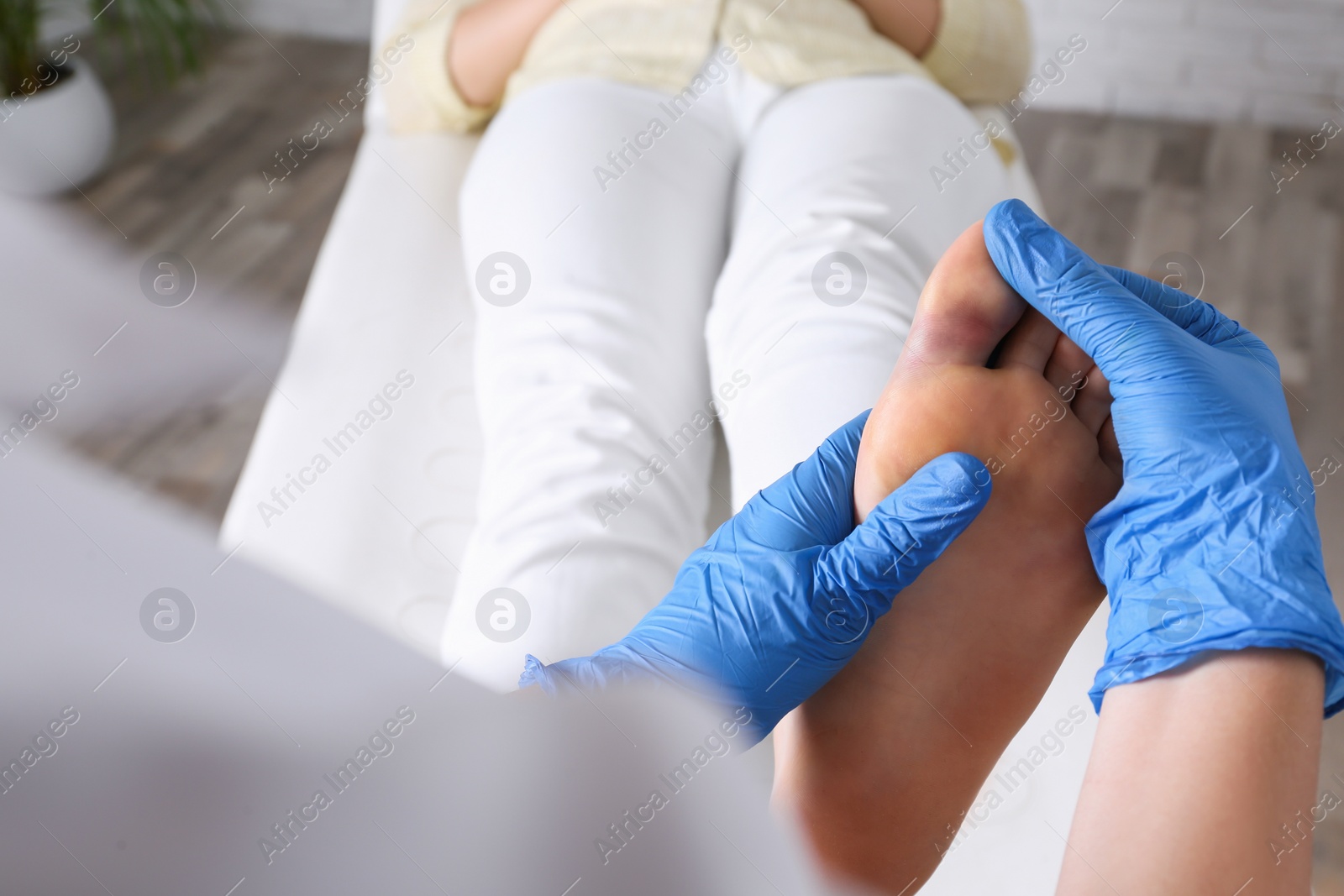 Photo of Doctor checking woman's foot with bruise at hospital, closeup