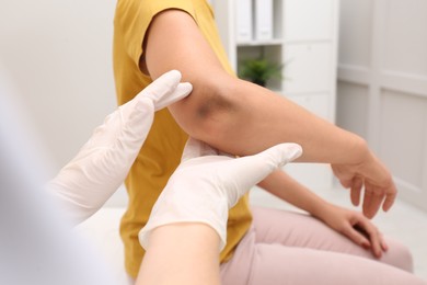 Photo of Doctor examining woman with bruise on elbow in clinic, closeup