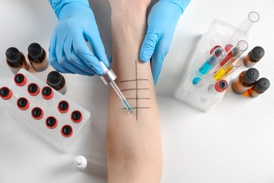 Photo of Doctor doing skin allergy test at light table, top view