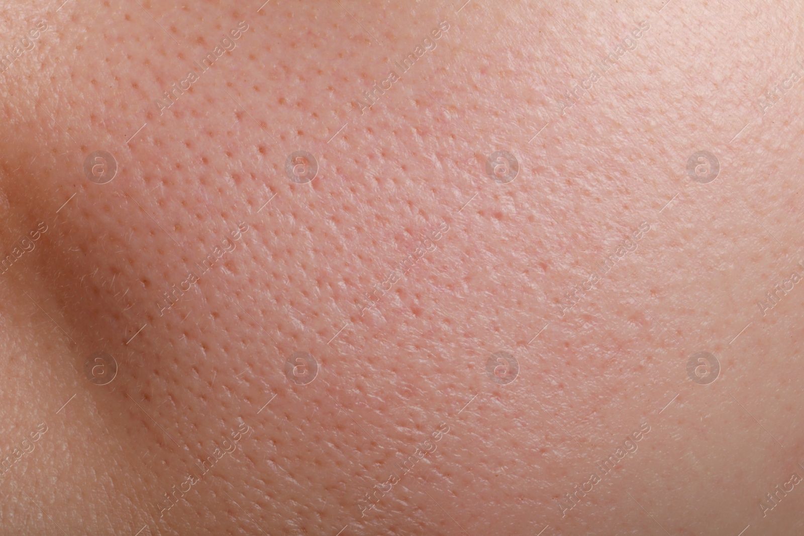 Photo of Closeup view of human skin as background