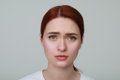 Photo of Upset woman with yellow eyes on light grey background. Symptom of hepatitis