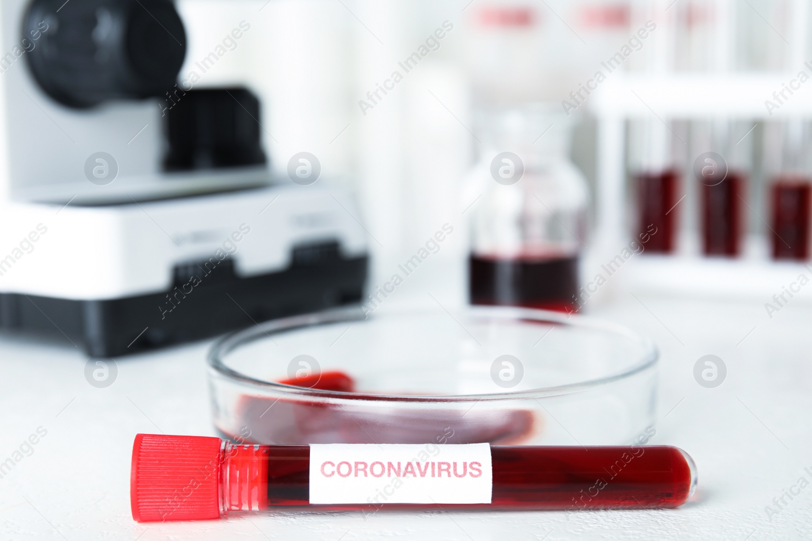 Photo of Test tube with blood sample and label CORONA VIRUS and Petri dish on table in laboratory, closeup