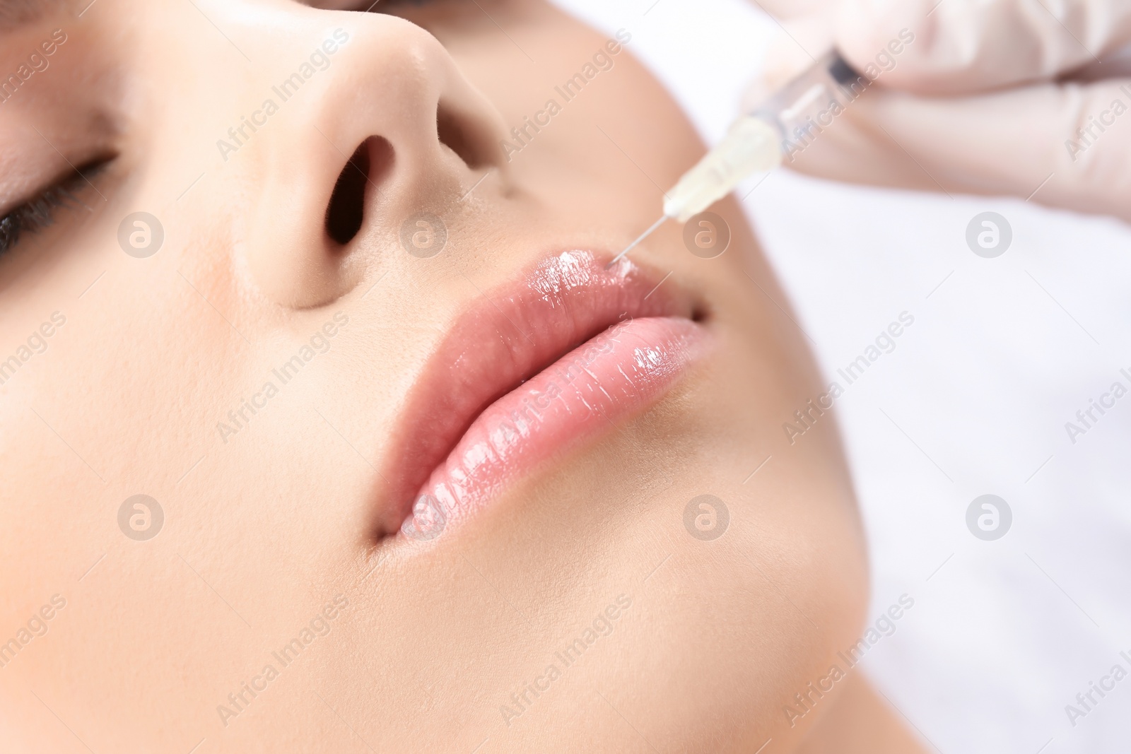 Photo of Young woman getting lip injection in beautician salon, closeup