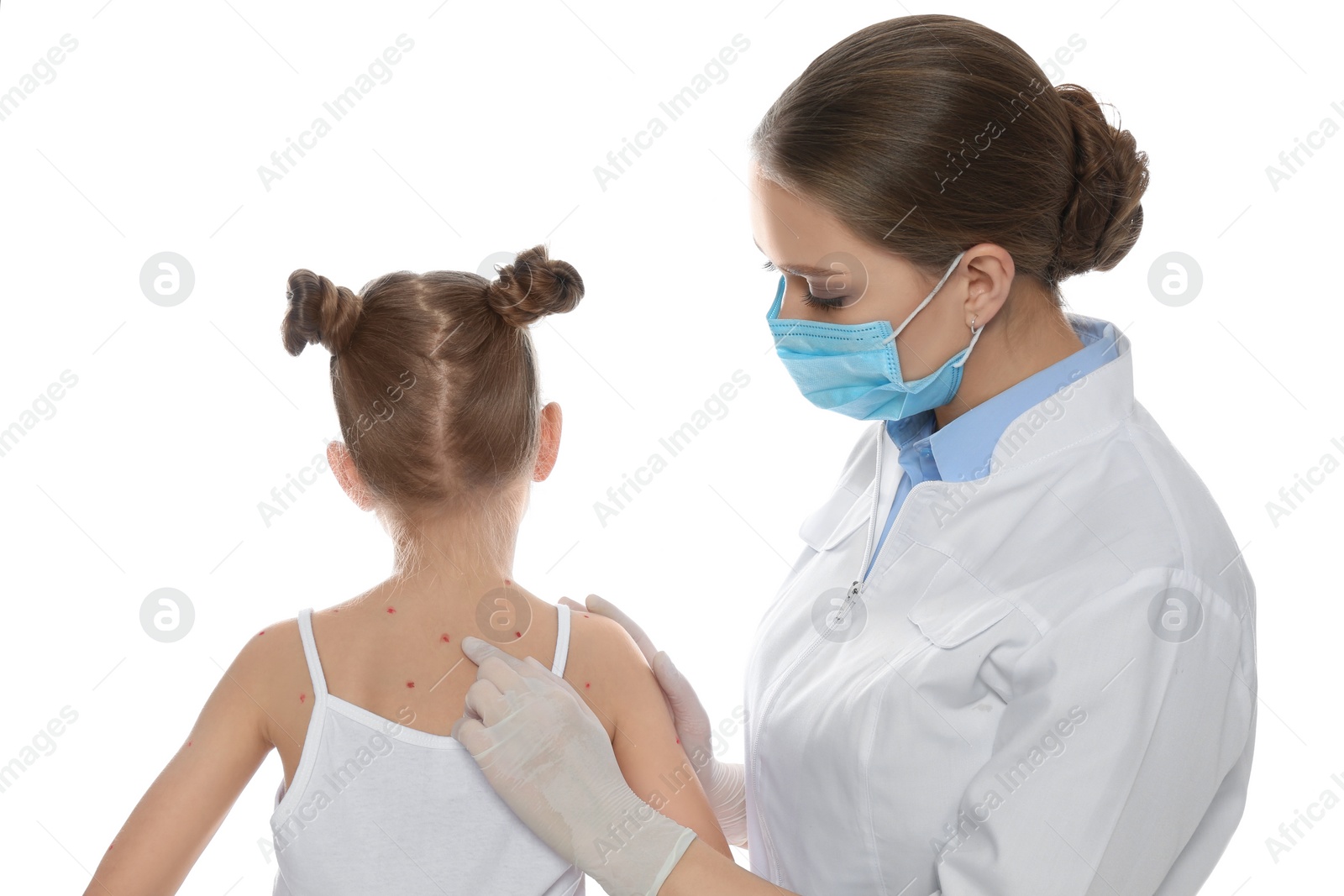 Photo of Doctor examining little girl with chickenpox on white background. Varicella zoster virus