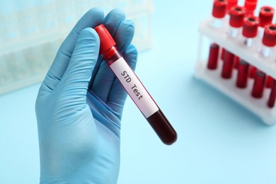 Photo of Scientist holding tube with blood sample and label STD Test on light blue background, closeup