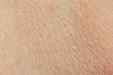 Photo of Texture of dry skin as background, macro view