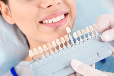 Photo of Dentist selecting patient's teeth color with palette in clinic, closeup
