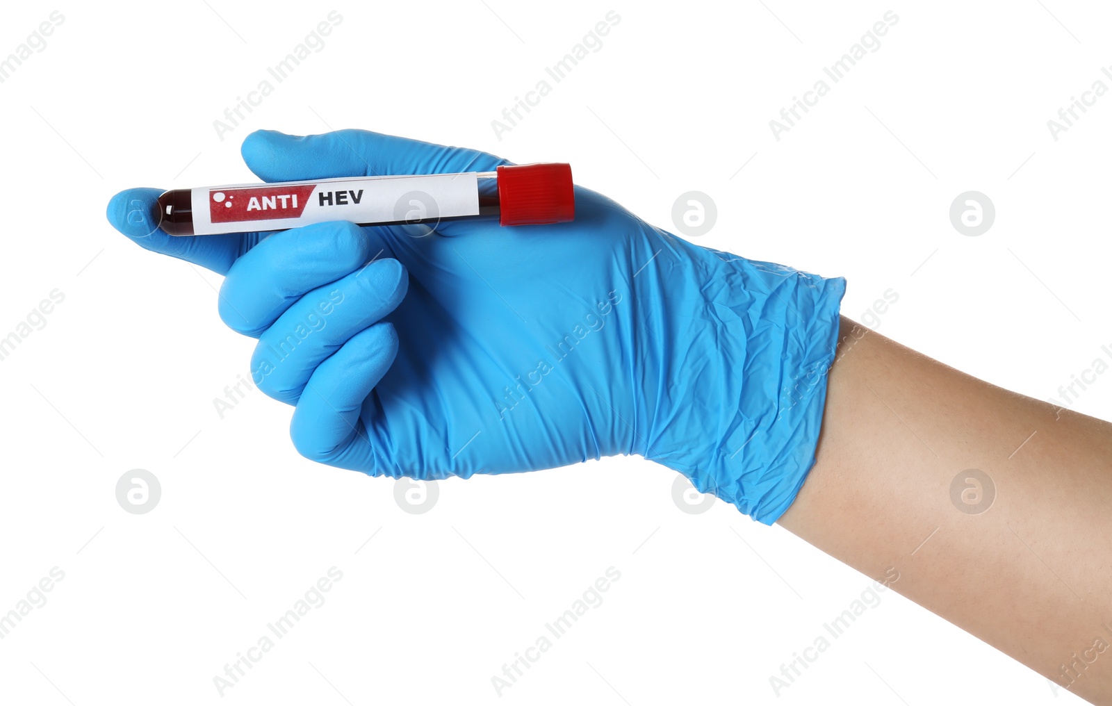 Photo of Scientist holding tube with blood sample and label Anti HEV on white background, closeup