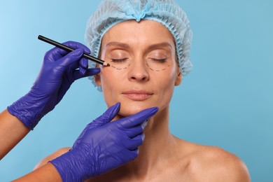 Photo of Doctor with pencil preparing patient for cosmetic surgery operation on light blue background, closeup