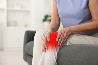 Image of Arthritis symptoms. Woman suffering from pain in her knee on sofa indoors, closeup. Space for text