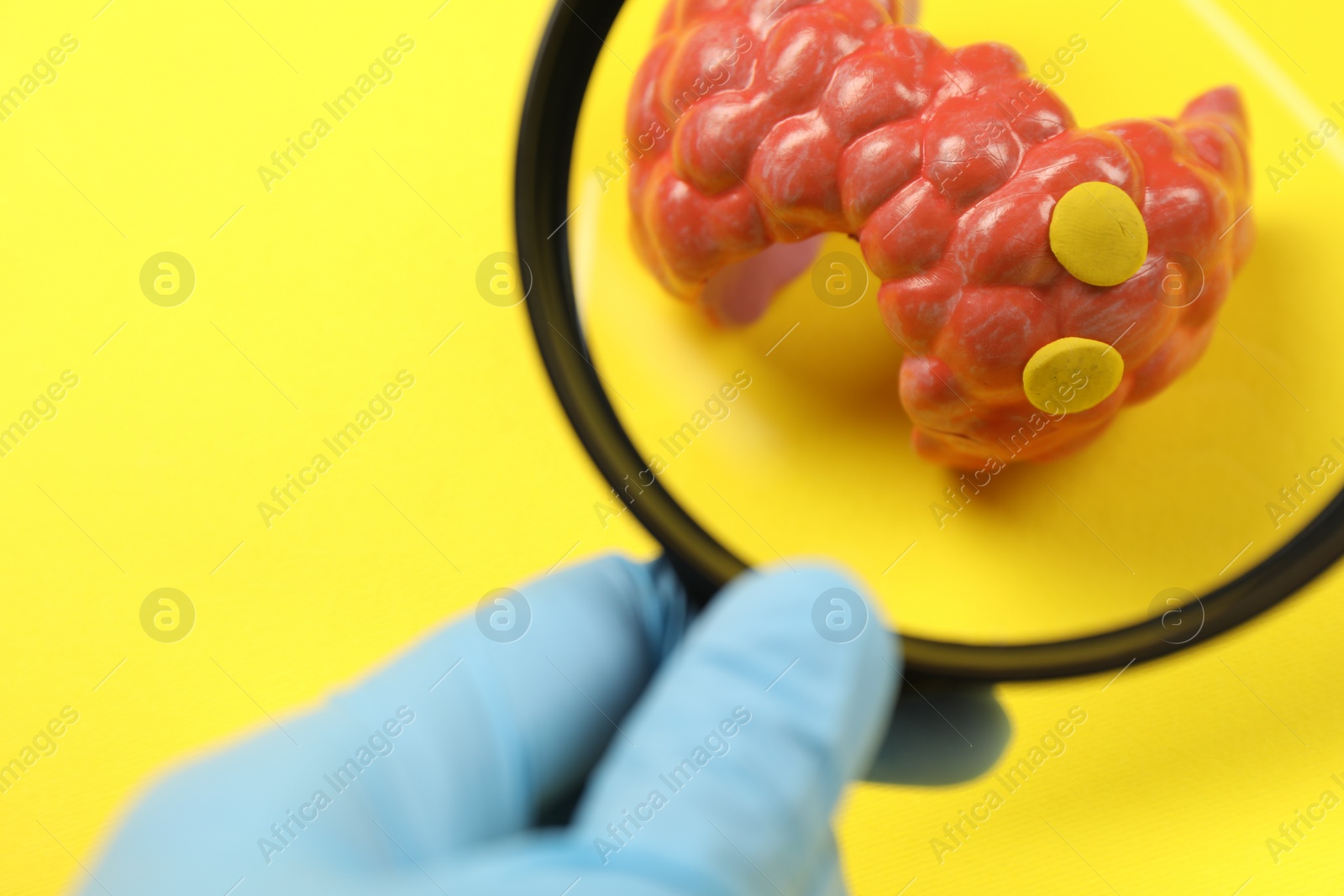 Photo of Endocrinologist looking at model of thyroid gland through magnifying glass on yellow background, closeup