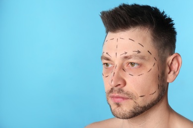 Man with marks on face for cosmetic surgery operation against blue background. Space for text
