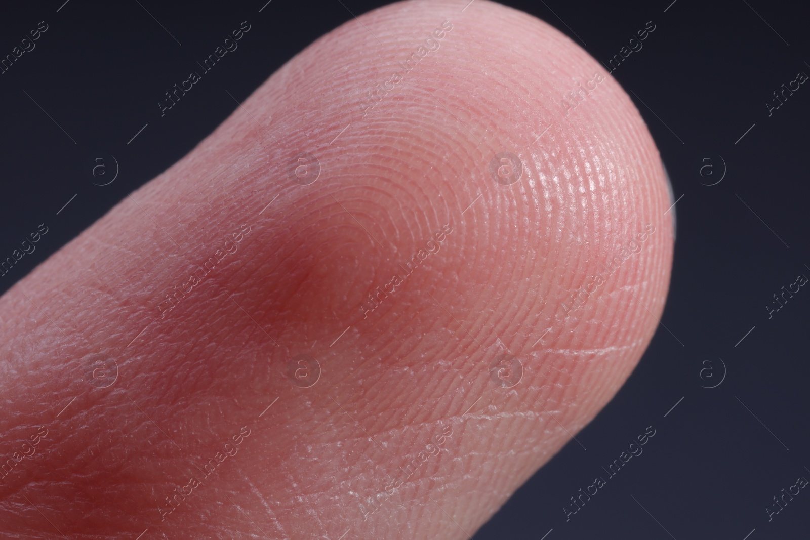 Photo of Finger with friction ridges on dark background, macro view