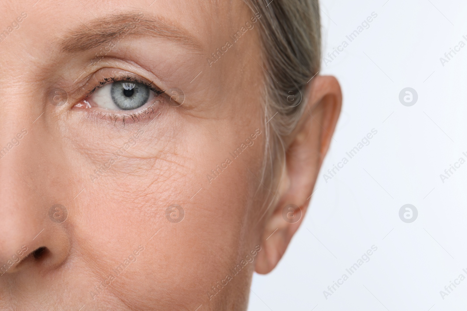 Photo of Senior woman with aging skin on white background, closeup. Rejuvenation treatment