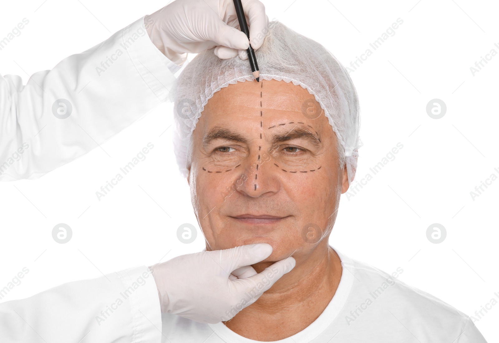 Photo of Doctor marking senior man face before cosmetic surgery on white background