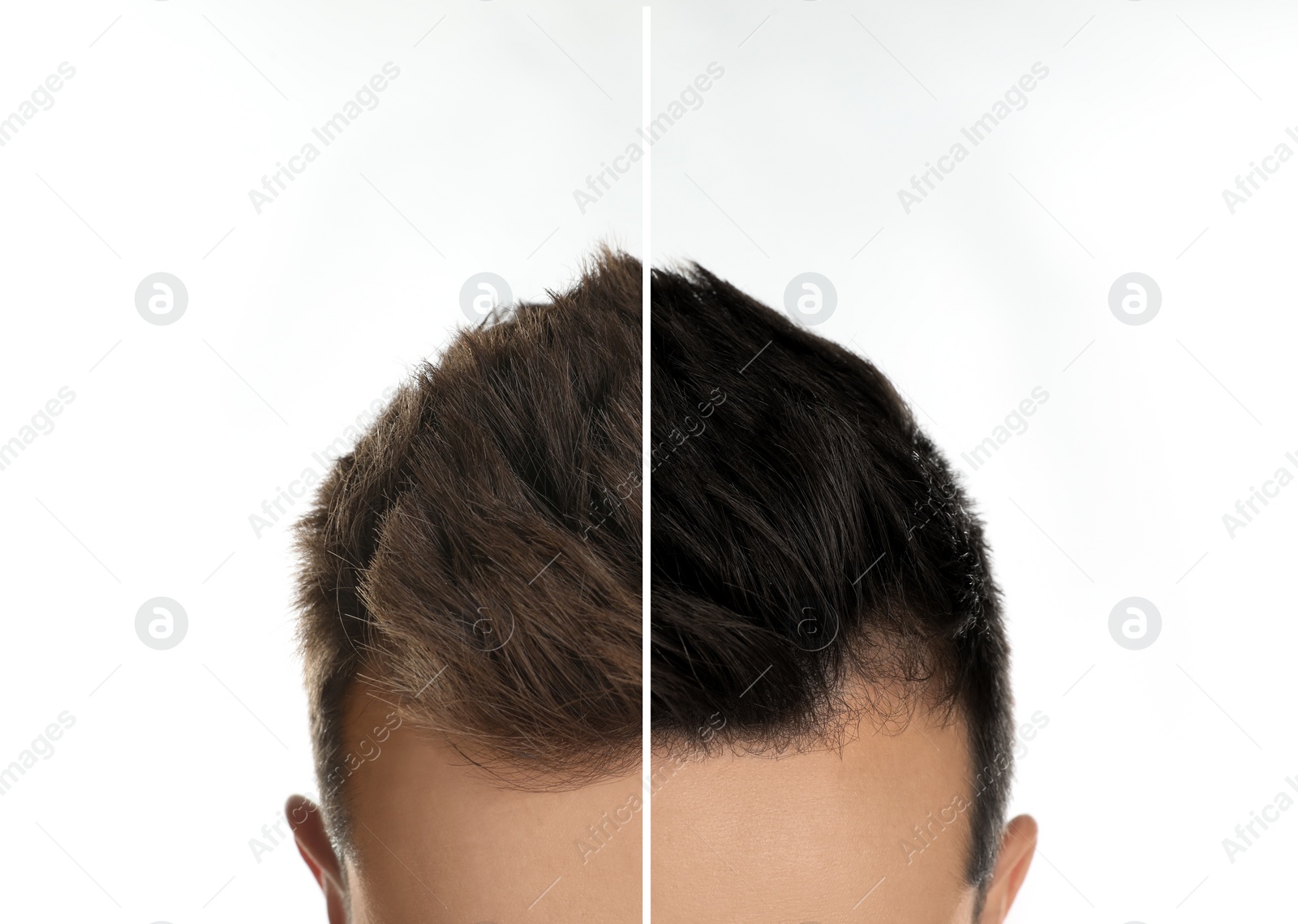 Image of Closeup view of man before and after hair dyeing on light background, collage