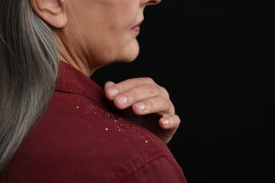 Woman brushing dandruff off her shirt on black background, closeup. Space for text