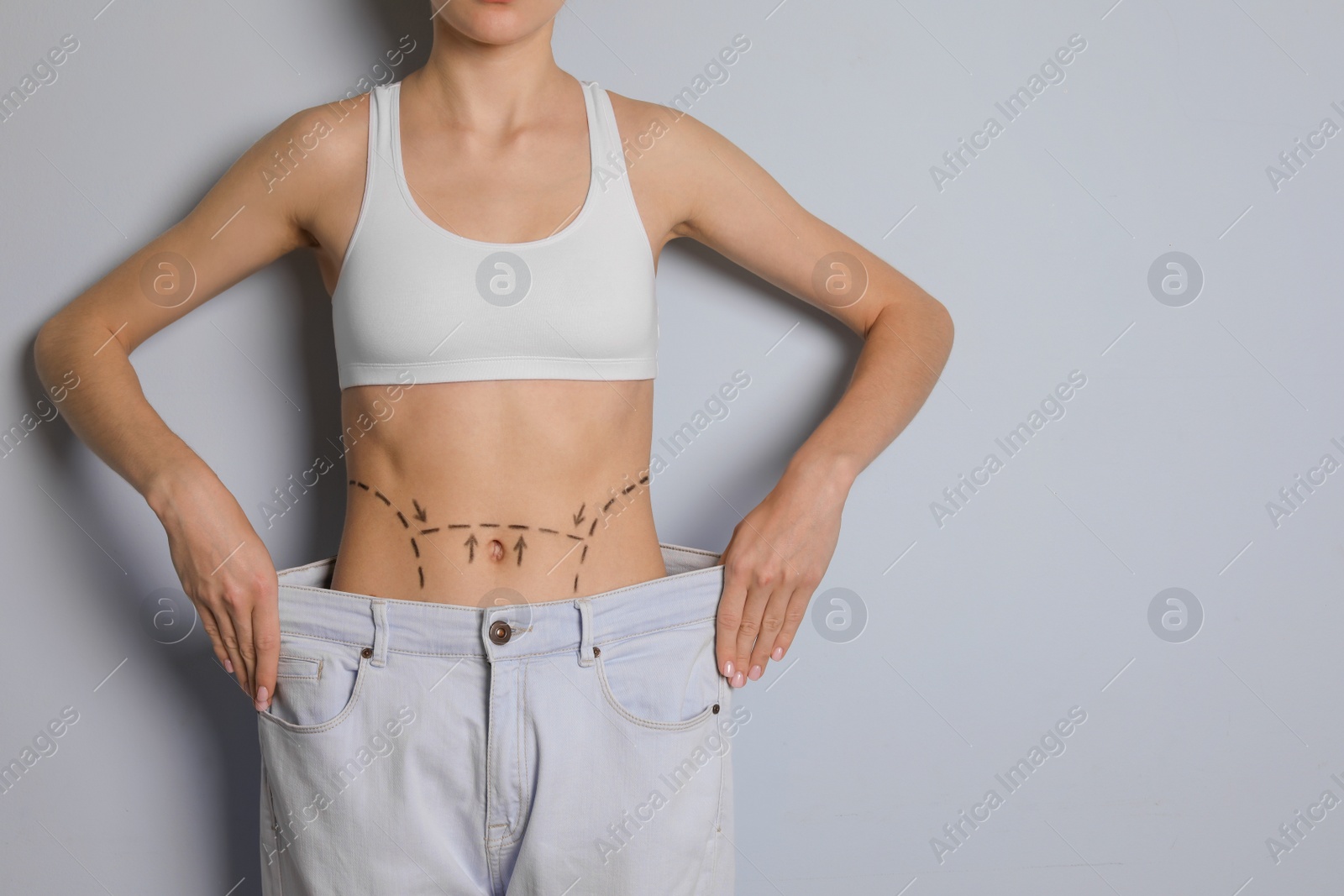 Photo of Young woman with marks on belly in big jeans after cosmetic surgery operation against color background