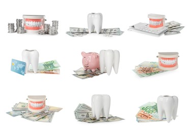 Image of Set with educational dental models and money on white background. Expensive teeth treatment