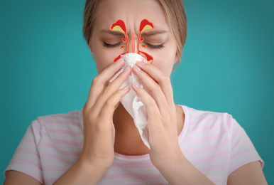 Image of Woman suffering from runny nose as allergy symptom. Sinuses illustration on face