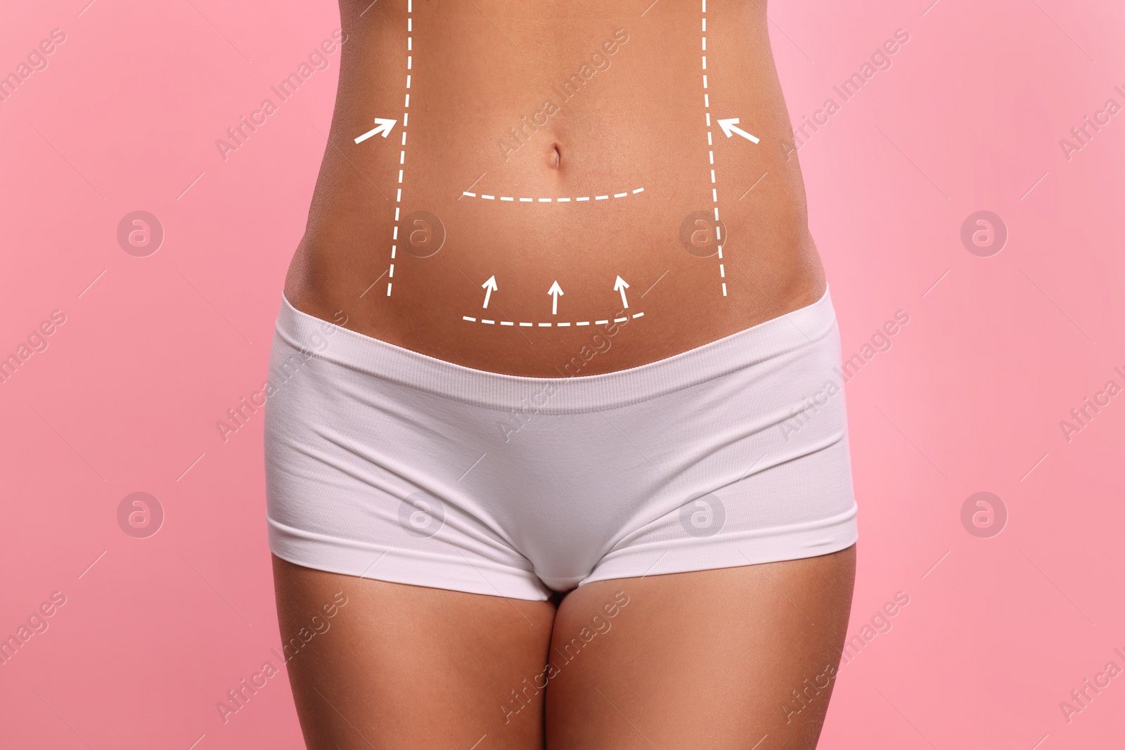 Image of Woman with markings for cosmetic surgery on her abdomen against pink background, closeup