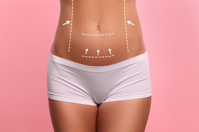 Woman with markings for cosmetic surgery on her abdomen against pink background, closeup