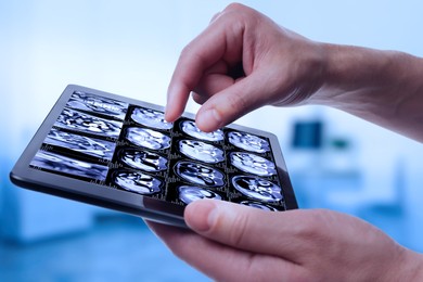 Image of Doctor examining x-ray images on tablet indoors, closeup