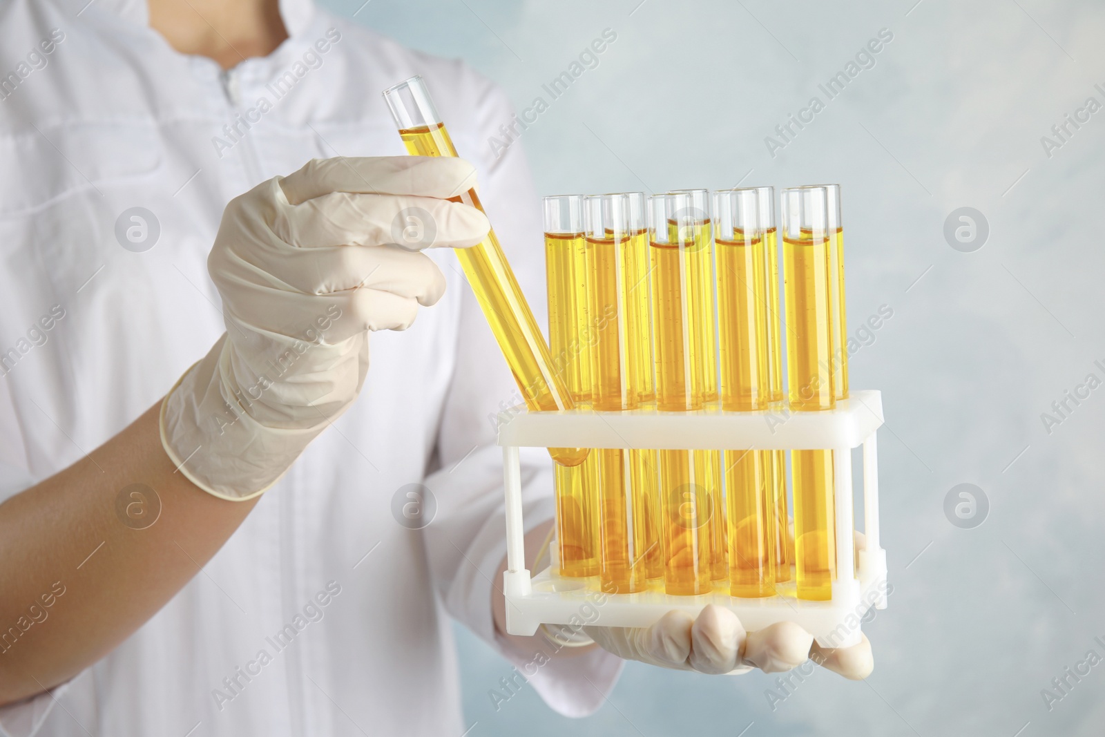 Photo of Doctor holding test tubes with urine samples for analysis on light blue background, closeup